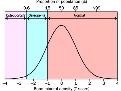Diagnóstico Osteoporosis
